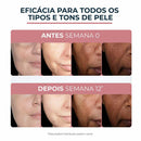 Eucerin Anti-pigment Clareador Creme Facial Dia FPS 30 50ml